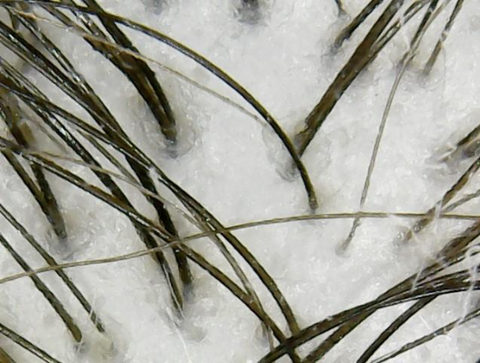 Image of Super USB Microscope Camera - 1000X Zoom