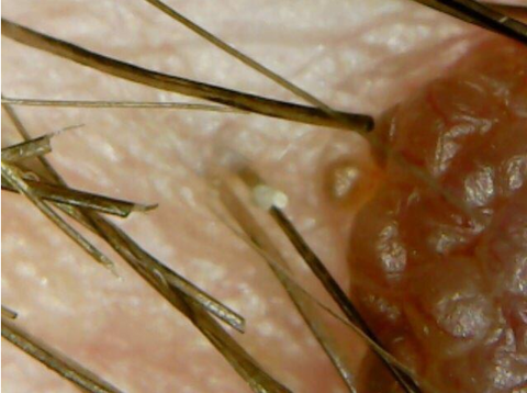 Image of Super USB Microscope Camera - 1000X Zoom