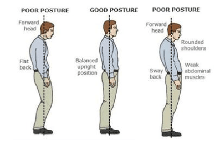 The Best Posture Corrector