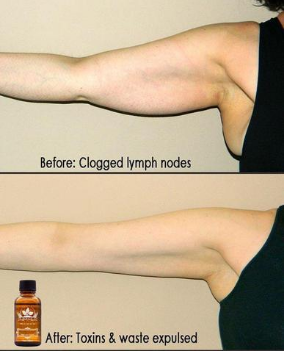 Image of Premium Ginger Oil - Improves Swelling, Joint Pain, Infection