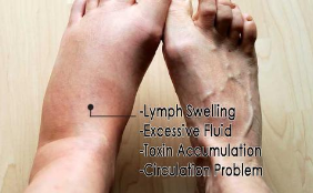 Image of Premium Ginger Oil - Improves Swelling, Joint Pain, Infection